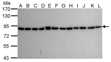 Anti-Ku80 antibody [9403] used in Western Blot (WB). GTX70274